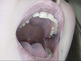 300人のおくち 第2集　サンプル画像10